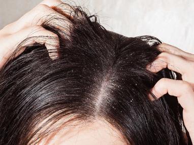8 Easy Ways To Save Your Hair From Hard Water. Effects And Hair Repair.