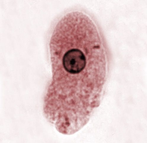 Entamoeba Histolytica